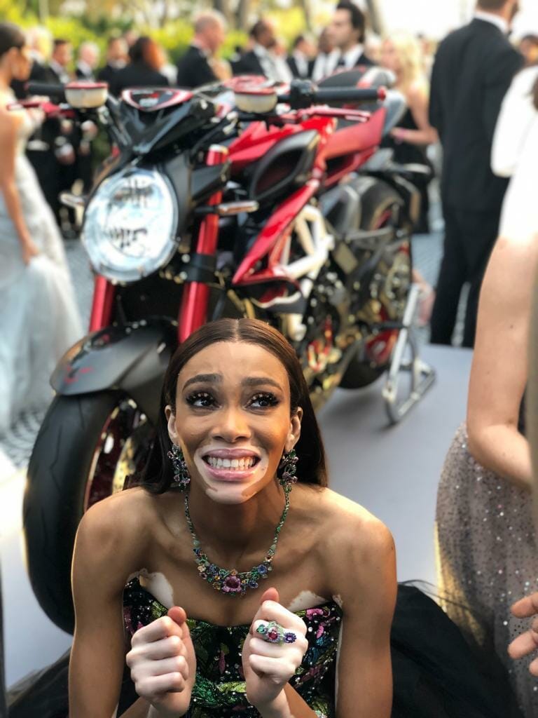 Winnie Harlow
