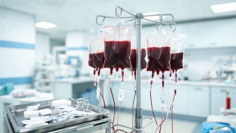 Vier Blutkonserven-Beutel an einem Infusionsständer in einem Krankenhaus-Labor, daneben ein Edelstahl-Tablett mit medizinischem Zubehör – Symbolbild Blutspende und Blutkonserven-Mangel